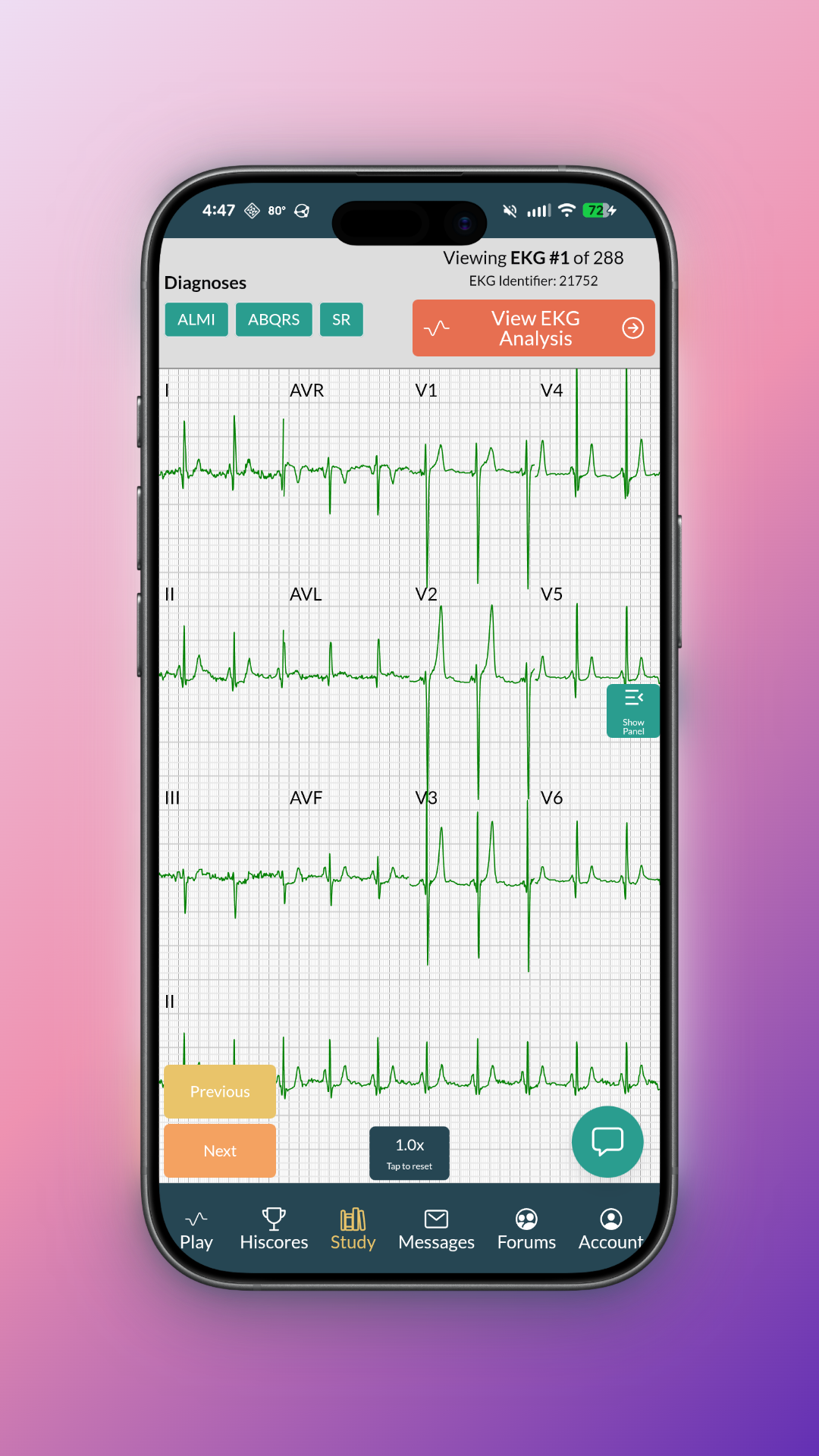 EKG Battle App Screen 3